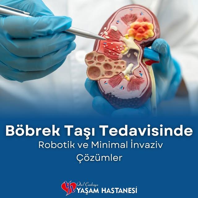 Böbrek ve Üreter Taşları Tedavisinde Yeni Gelişmeler